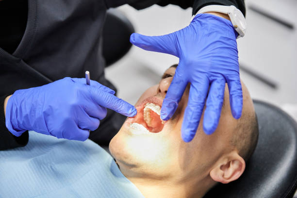Best Emergency Tooth Extraction in Ainaloa, HI